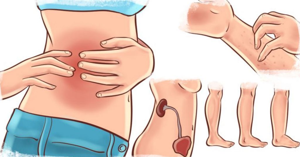 Warning-Signs-of-Kidney-Problem-and-simple-solutions-to-cure-it-0